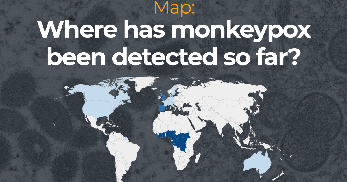 Map: Where has monkeypox been detected so far?  |  Infographic News