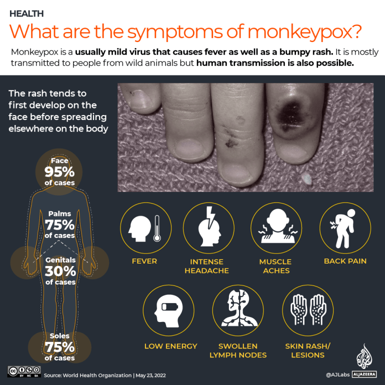 INTERACTIVE- Monkeypox signs and symptoms
