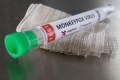 Monkeypox test tube