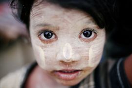 Rohingya refugee child with thanaka paste on her cheeks and forehead in Cox's Bazar,