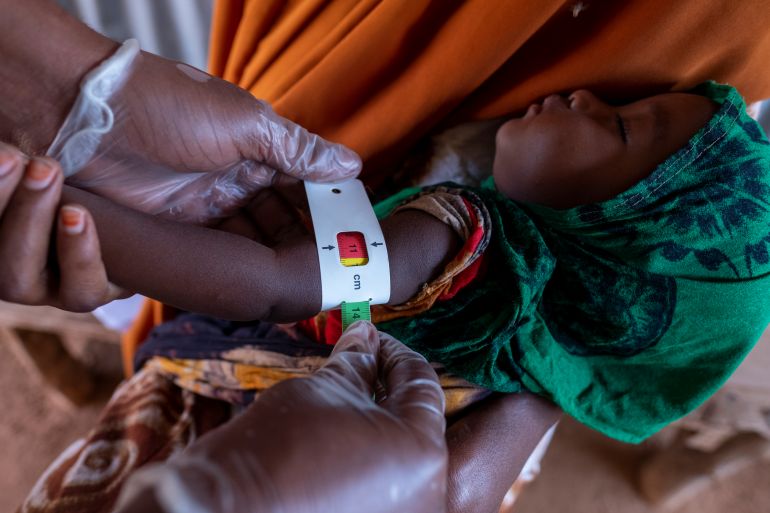 A child, 7 month old Fardowsa Adan Mohamed being examined in a unicef funded clinic to find the extemt of malnutrion due to the severe drought in the region.