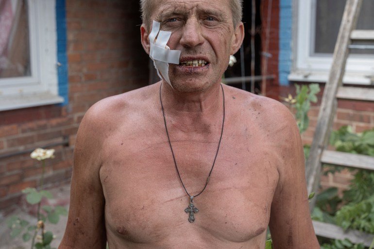 Yurii Sherbakov, 53, stands in front of a destroyed house where he was injured during shelling, in Sloviansk, Donetsk region, Ukraine.
