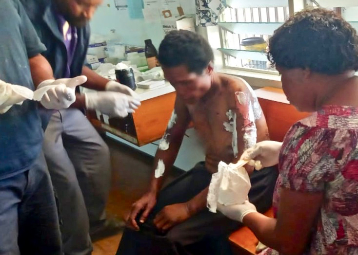 O victimă a SARV primește tratament medical pentru rănile sale