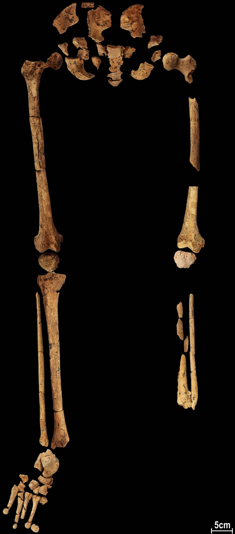 Borneo skeleton may show 31,000 year old amputation | Science and Technology News