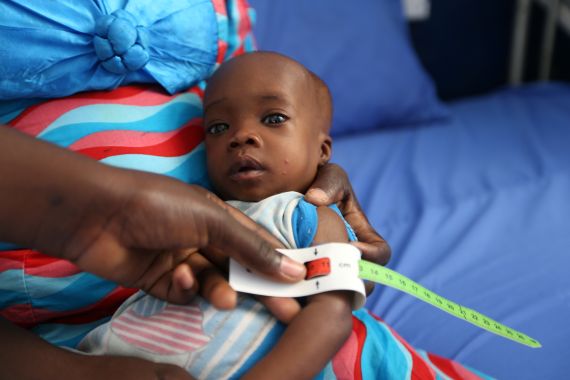 A muac tape used to screen malnutrition in children at the stabilisation ward in Molai General Hospital Maiduguri, Nigeria November 30, 2016