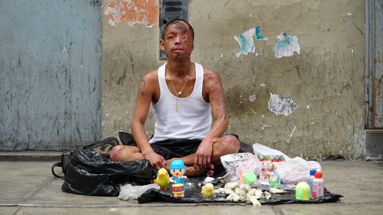 Jeancarlos Delcolca, who suffered a disfiguring injury, sits on the sidewalk selling small trinkets