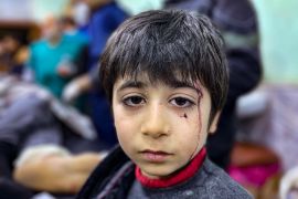 An injured child awaits treatment at the Bab al-Hawa hospital in the opposition-held northern countryside of Syria&#39;s Idlib province on the border with Turkey [Aaref Watad/AFP]
