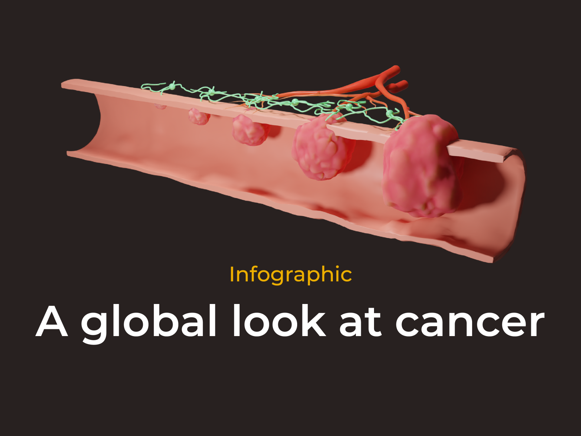 Infographic: A global look at cancer