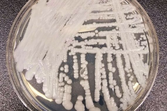 The Centers for Disease Control and Prevention shows a strain of Candida auris cultured in a petri dish at a laboratory