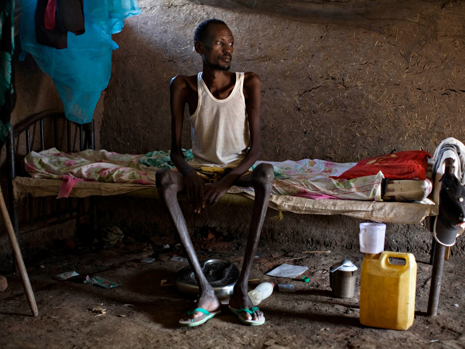 Tingkat tuberkulosis meroket di tengah konflik Ukraina, Sudan |  Berita Kesehatan