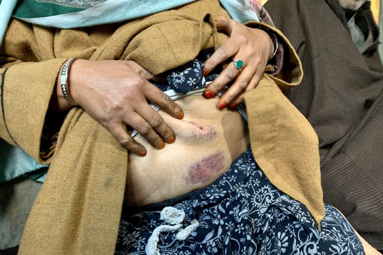 Sharifa Begum showing the aftermath of the attack by wild boar which crashed into her family’s vegetable garden recently