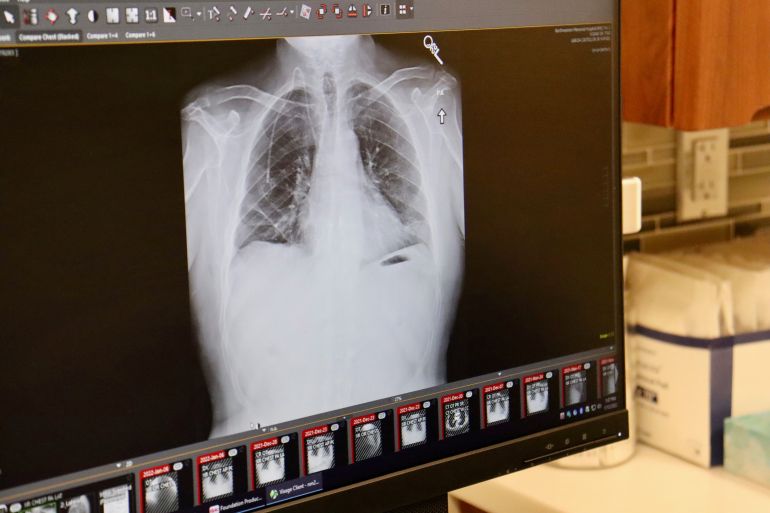 A computer screen displays an X-Ray