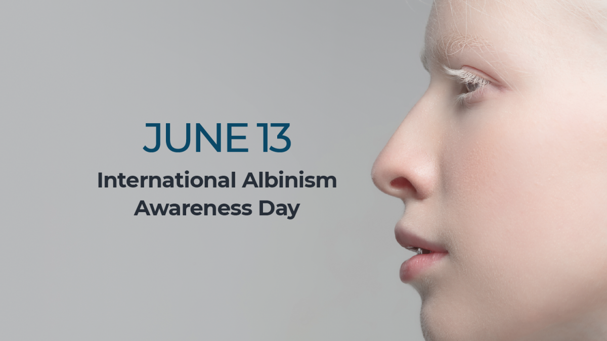INTERACTIVE Albinism awareness day 1686631767