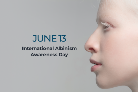 INTERACTIVE Albinism awareness day-1686631767