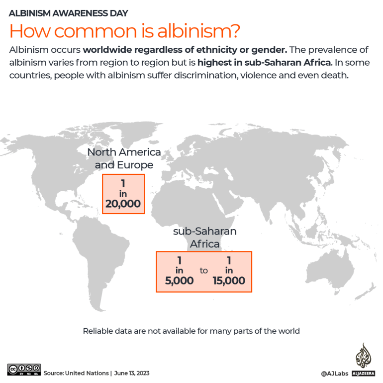 Interactive Albinism Awareness Day - How Common Is Albinism-1686631743