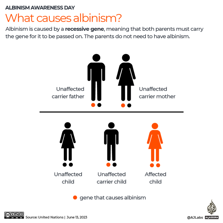 INTERACTIVE Albinism awareness day - what causes albinism-1686631748