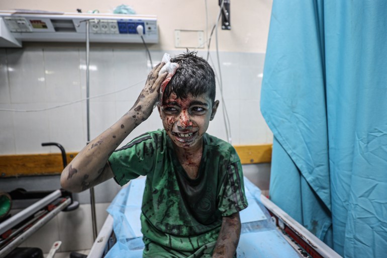 An injured Palestinian kid sits on a stretcher waiting to receive medical care at Nasser Hospital after Israeli airstrike in Khan Yunis, Gaza 