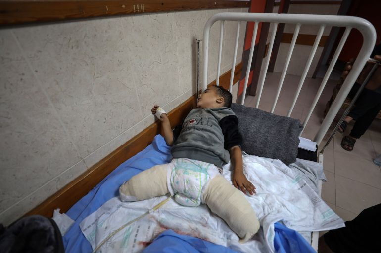 3-річний Ахмад Шабат провів на операційному столі три години
