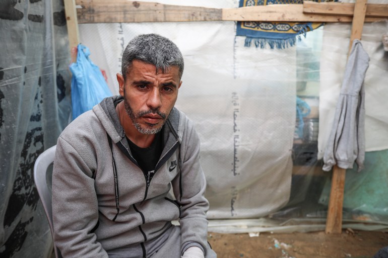 Ayman Harb, who was injured after Israeli warplanes targeted a market in Shujaiyeh, was forced to flee to central Gaza Strip with his family who are living in a tent for displaced people 