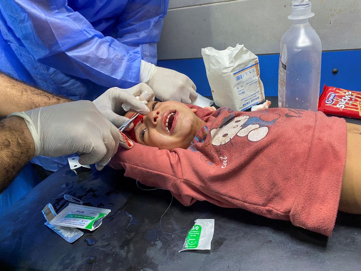 alestinian girl Orheen Al-Dayah, who was injured in her forehead in an Israeli strike amid the ongoing conflict between Hamas and Israel, has her wounds stitched without anaesthesia, at Al Shifa hospital in Gaza City