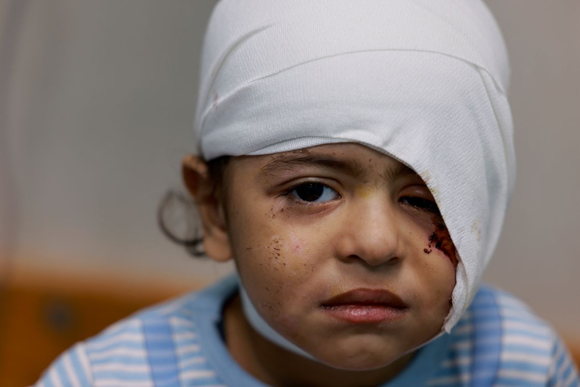 A wounded Palestinian child from the Jabalia refugee camp sits on a bed after being transferred from the Indonesian Hospital in the north to the Naser Hospital in Khan Yunis.