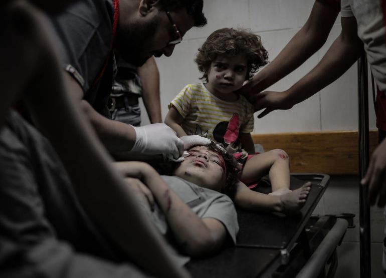 Injured children are seen at a hospital as the Israeli attacks continue on its 32nd day in Deir Al-Balah, Gaza on November 7, 2023.