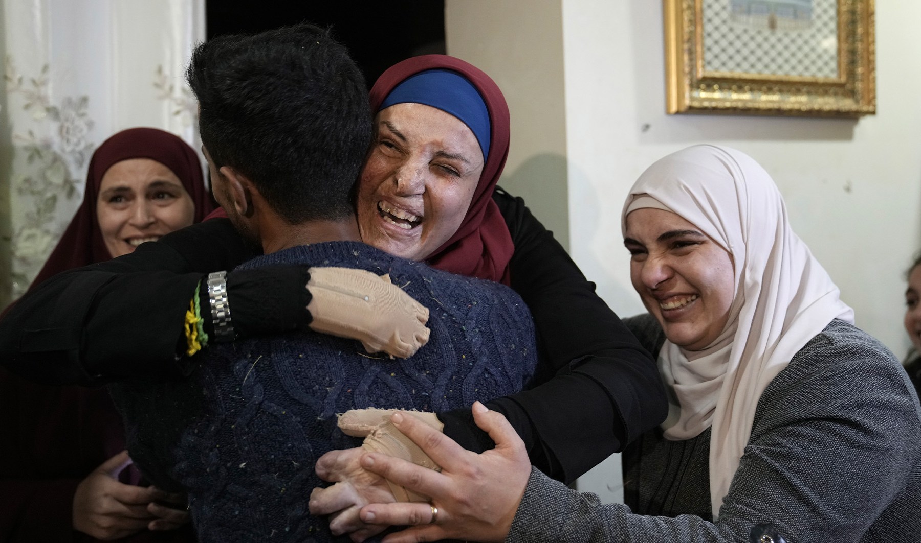 Israa Jaabis returns home after release from Israeli prison | Occupied East Jerusalem
