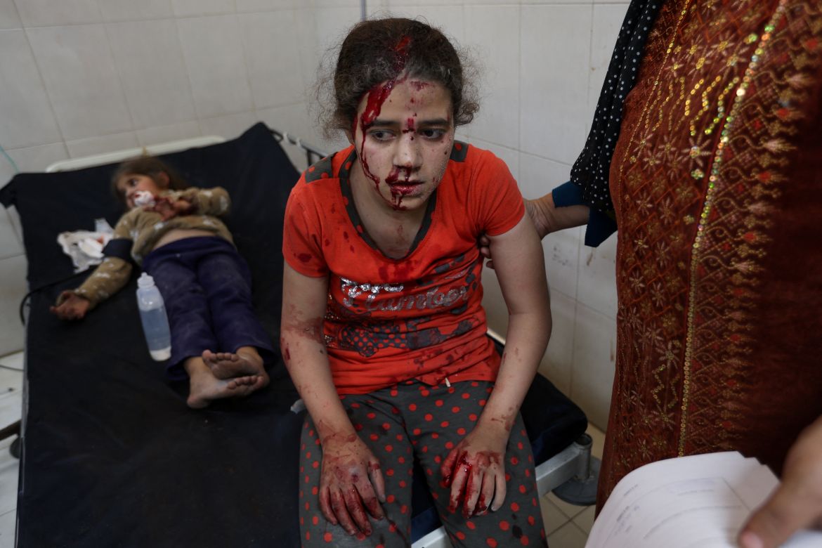 Wounded Palestinian children are assisted at Nasser hospital, following Israeli strikes, amid the ongoing conflict between Israel and the Palestinian Islamist group Hamas, in Khan Younis in the southern Gaza Strip, December 4