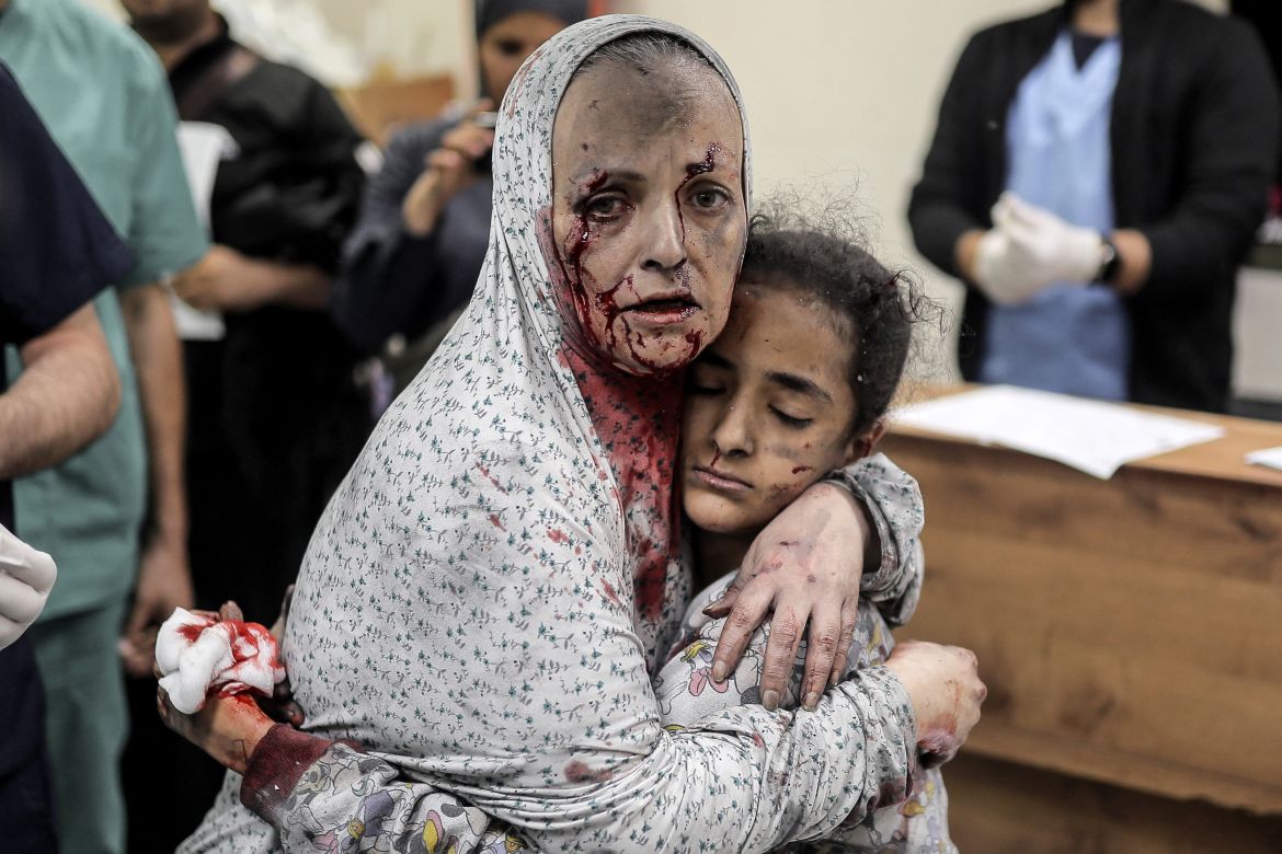 An injured Palestinian woman covered in dust and blood hugs an injured girl child at the hospital following the Israeli bombardment of Khan Yunis in the southern Gaza Strip.