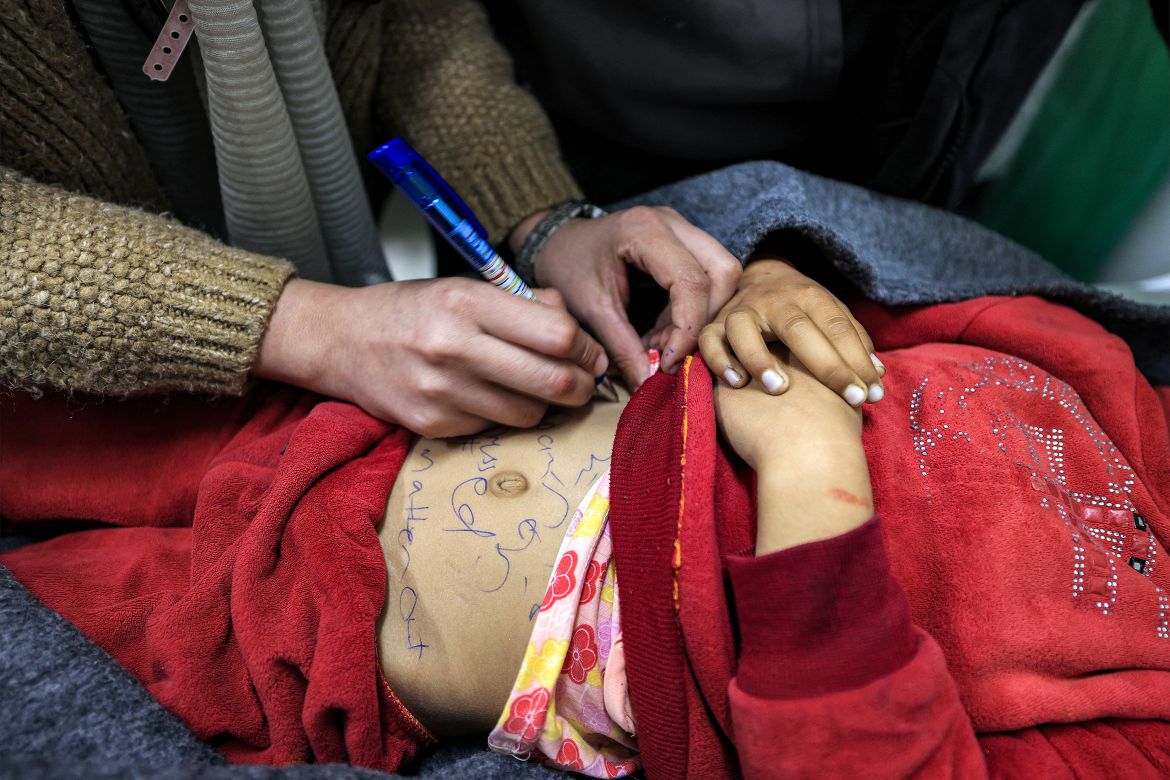 A nurse writes the identification information on the body of Sidal Abu Jamea, a Palestinian girl from Khan Yunis who died overnight while sleeping in a tent from a shrapnel fragment that hit her in the head following Israeli bombardment on a nearby position, at the Kuwaiti Hospital in Rafah in the southern Gaza Strip.