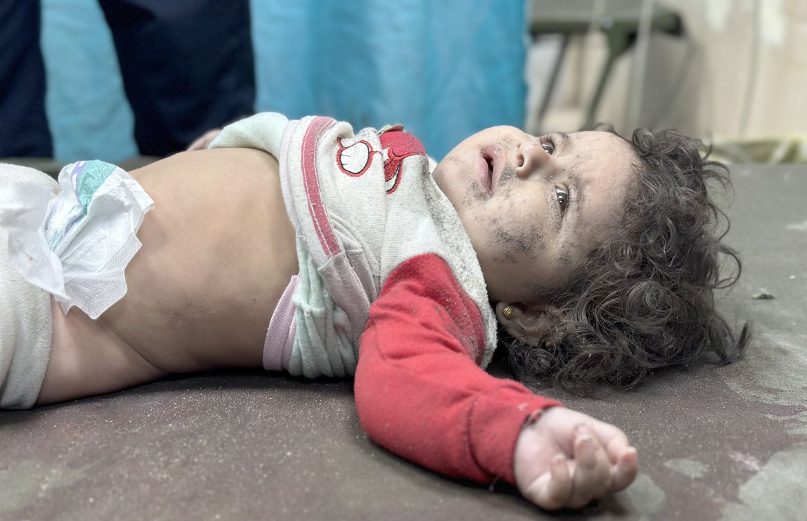 2-year-old Palestinian baby Larin Hussein, injured due to Israeli attack, is brought to the Aqsa Martyrs Hospital in Deir Al-Balah, Gaza on December 02, 2023. She had previously lost his parents in an Israeli airstrike
