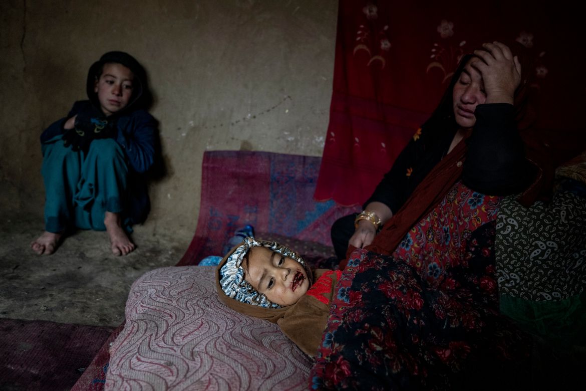 An internally displaced woman takes care of her sick child in a camp on the outskirts of Kabul, Afghanistan, Thursday, Feb. 9