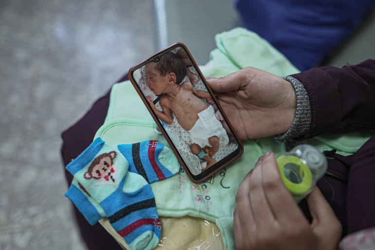 Ayman Marouf, Noor and Huthaifa's baby boy, was in a starved condition on November 19 2023 after he was transferred from al-Shifa Hospital to the Emirati Hospital in Rafah, southern Gaza Strip [Suleiman al-Farra/Al Jazeera]