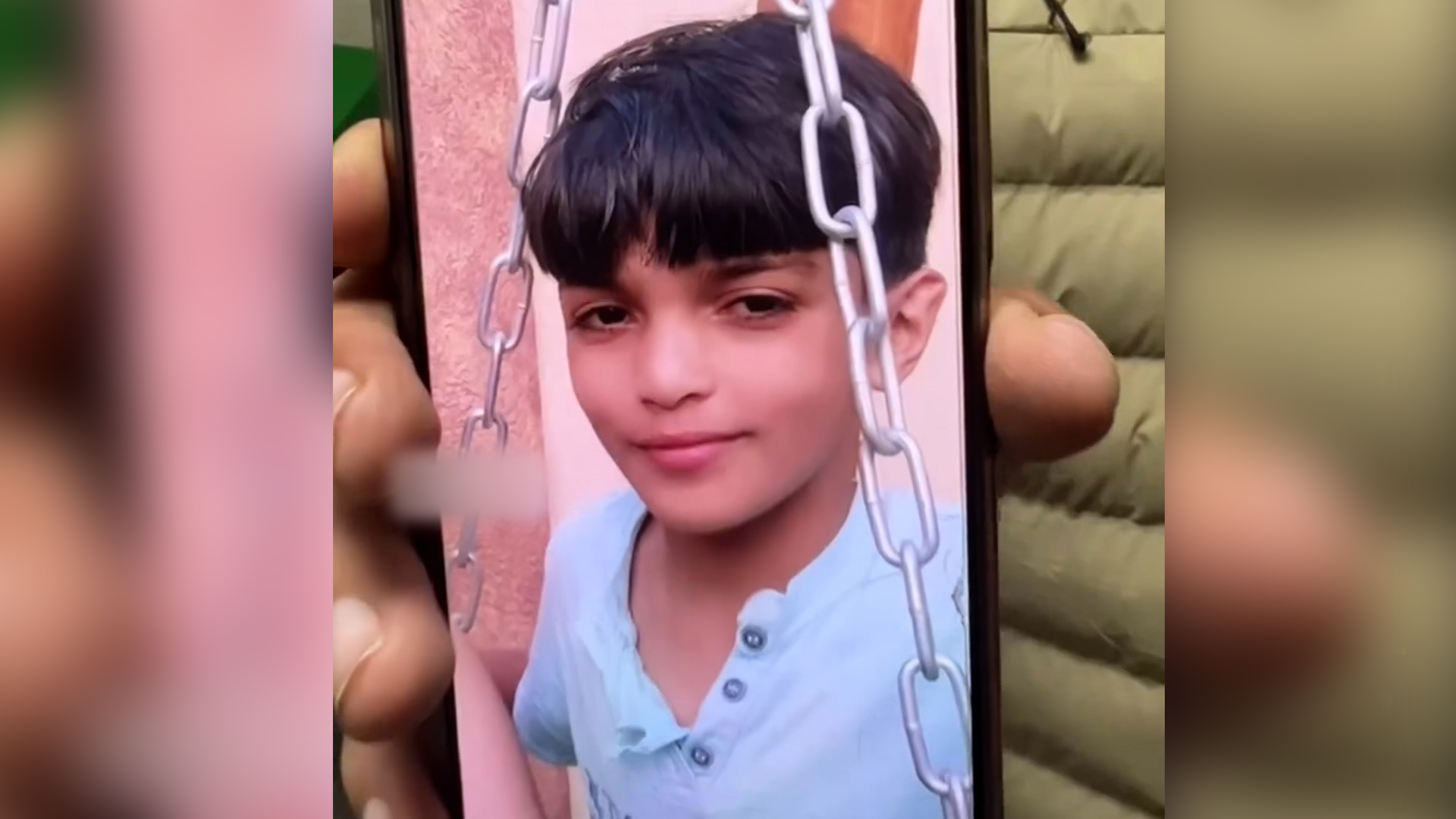 Injured Palestinian boy in Gaza no longer recognises his own face | Israel War on Gaza