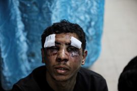 Gaza City resident Ramadan Shamlakh was assaulted by Israeli soldiers in his home on February 20, 2024 [Abdelhakim Abu Riash/Al Jazeera]