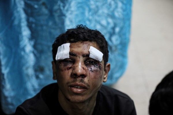 Дейр ел Балах, Газа – Кръв по цялото му лице