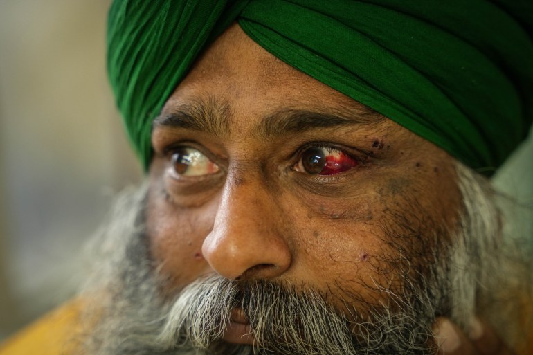 Balwinder Singh, his eye bloodied by a wound from an iron pellet fired by the police, in a hospital in Patiala, Punjab [Md Meherban/Al Jazeera]