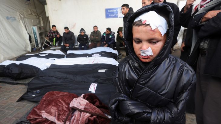 Child Injured from airstrike with martyrs in body bags behind him.