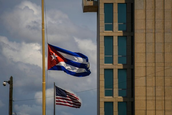 Няма доказателства за мозъчно увреждане при хора, страдащи от „синдром на Хавана“: американско проучване