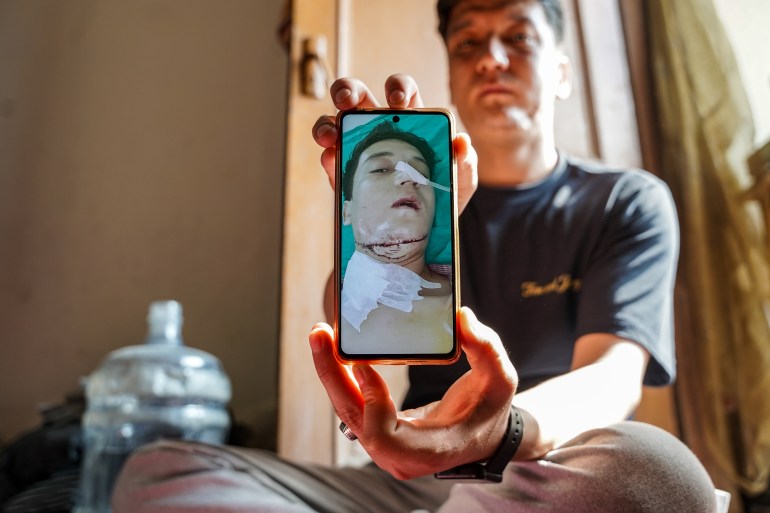 Zaki Marzai displaying his picture when he was hospitilised after sustaining injuries in the Taliban attack. Photo by Luqmaan Zeerak.